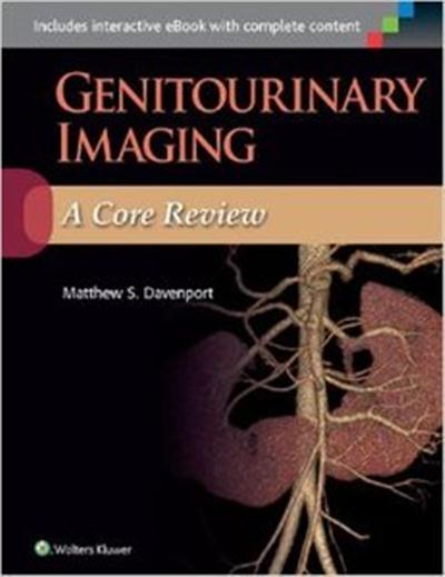 Genitourinary Imaging: A Core Review Genitourinary Imaging: A Core Review